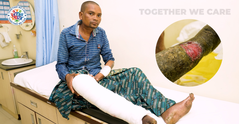 No Parents Or Support, This Infection Might Take My Leg Away